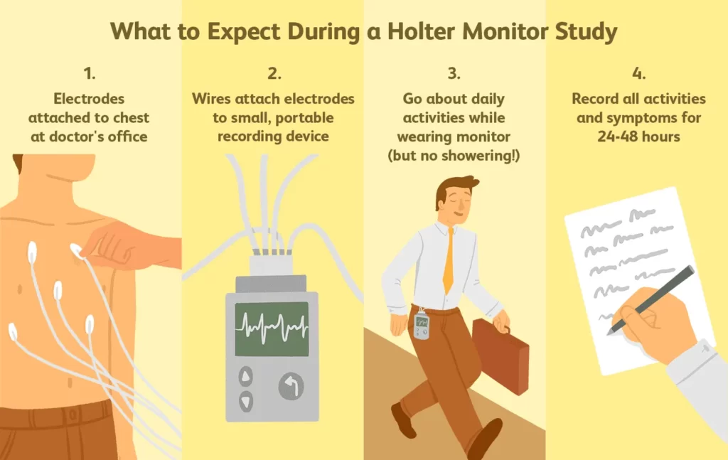 What Does a Holter Monitor Do