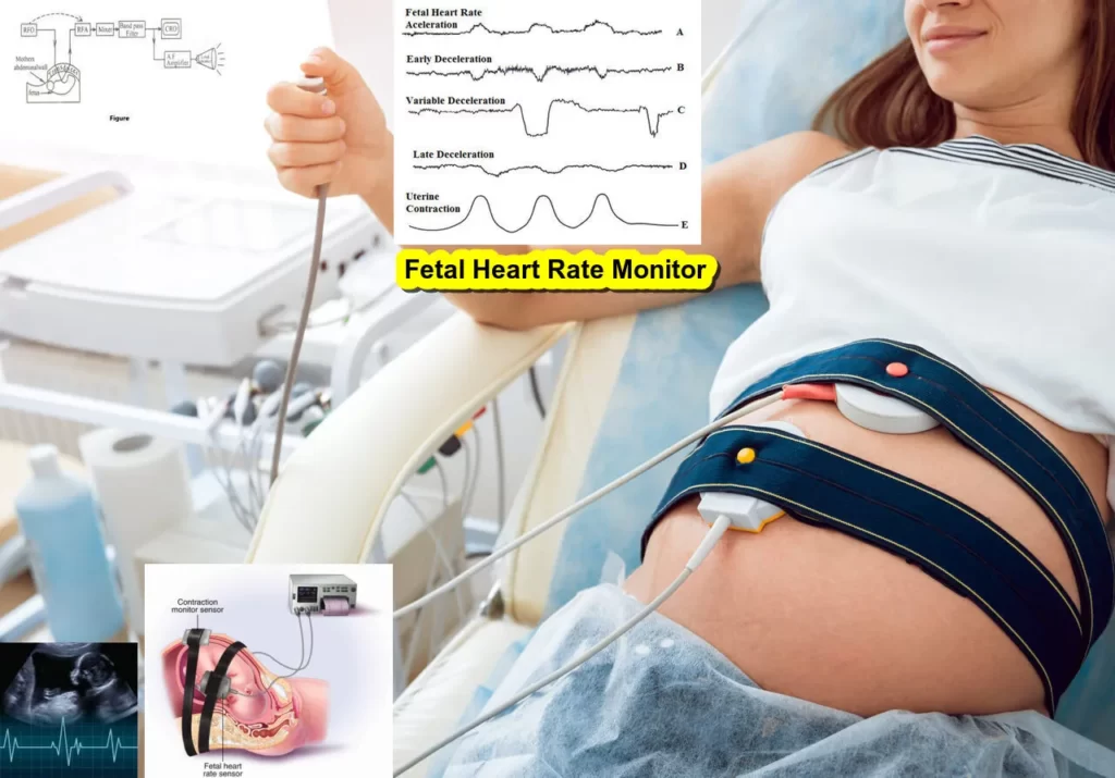 fetal heart rate monitor