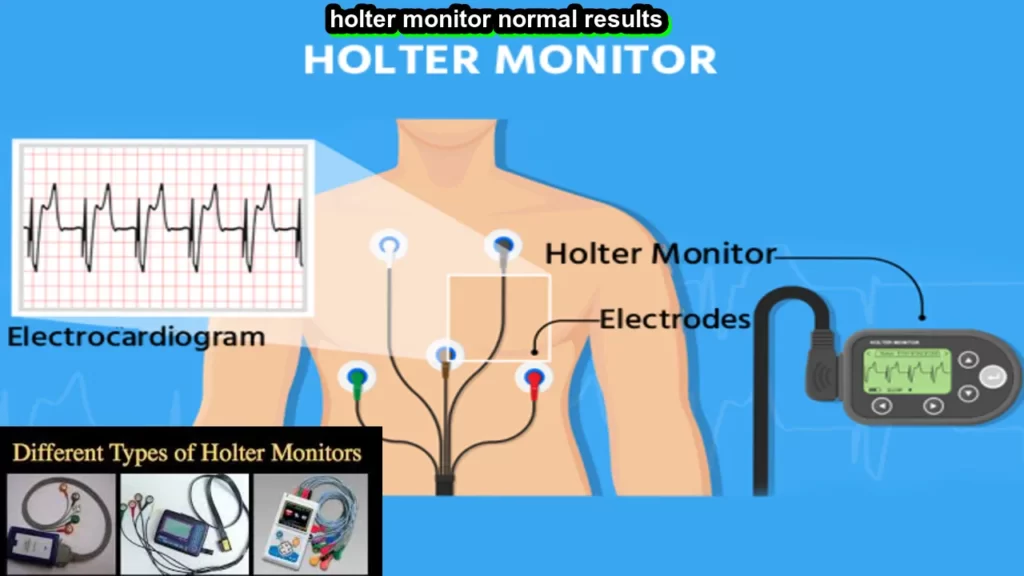 holter monitor normal results