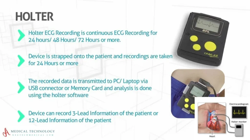48 hour holter monitor