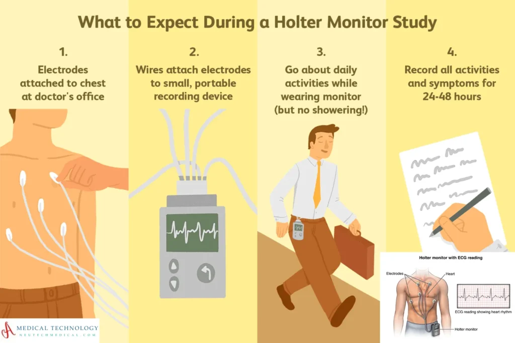 48 hour holter monitor