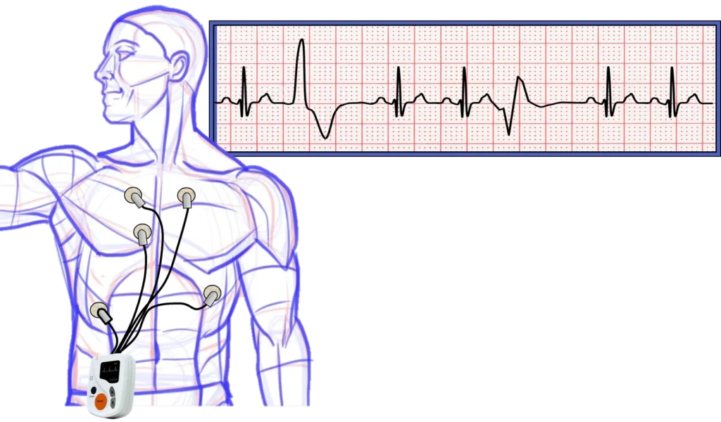 48 hour holter monitor